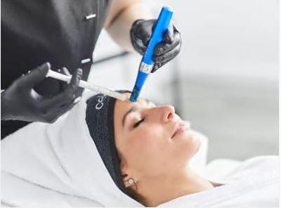 Microneedling Special Offer